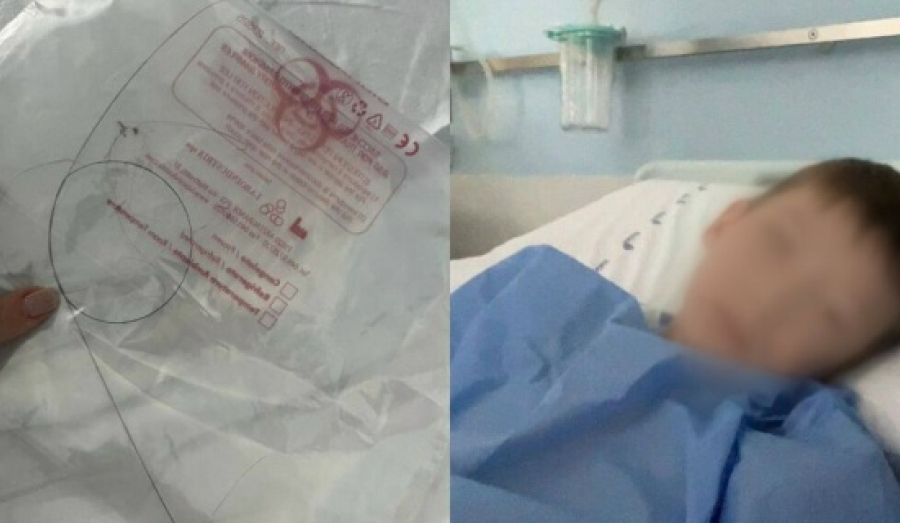 В Новосибирске врачи забыли в теле ребёнка инородный предмет