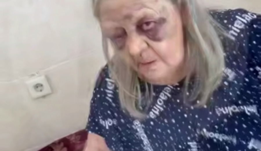 Бабушку избили в больнице в Мариинске