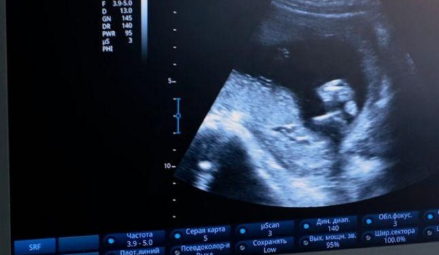 В Новосибирске девочка стала мамой в 11 лет