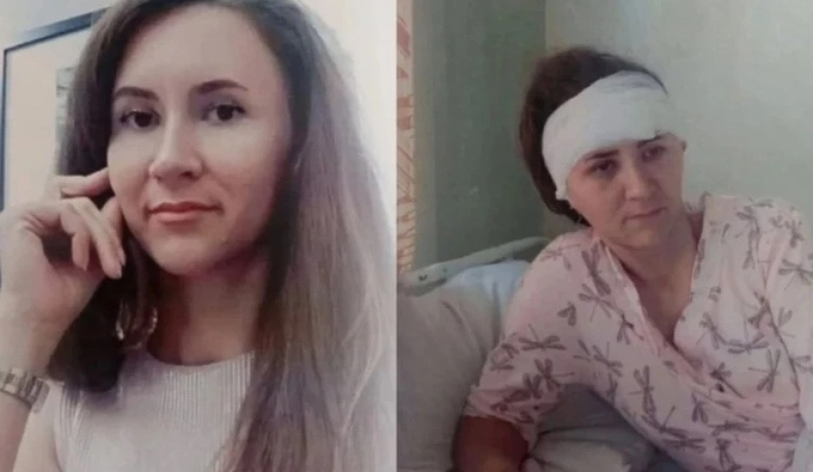 Суд смягчил приговор чиновнику из-за упавшей ветки на женщину с ребёнком