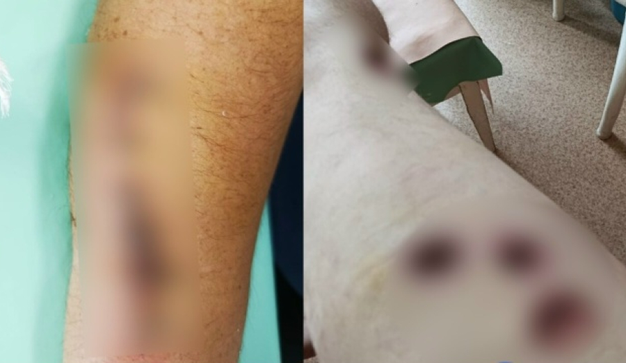 Супруги не могут добиться наказания для напавших на них с оружием